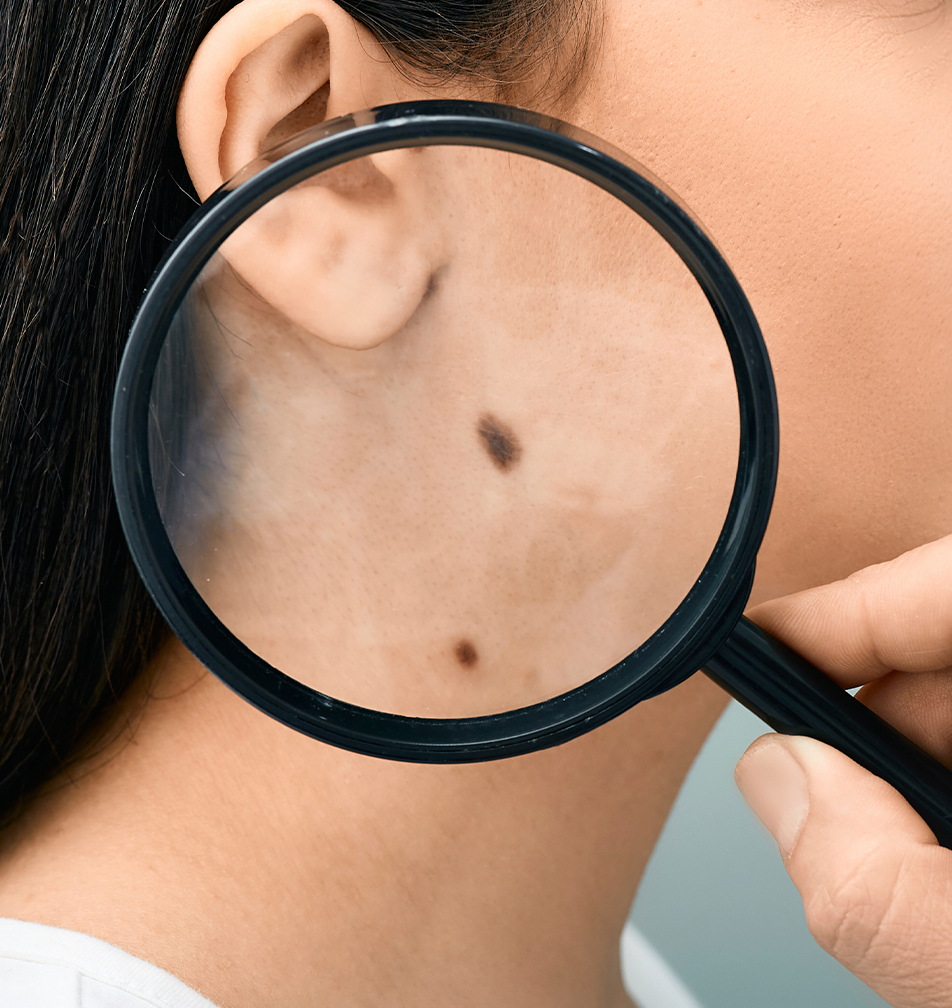 튀어나온 큰 점